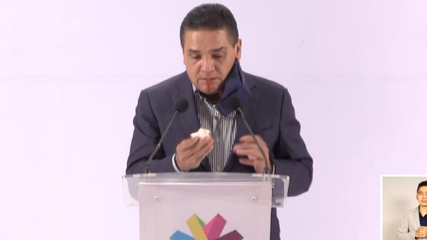 ¿Secuela de Covid-19? Gobernador es afectado por sangrado en plena conferencia