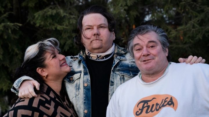 Tras quedar desfigurado en accidente, hombre se somete a trasplante de rostro y se ve irreconocible