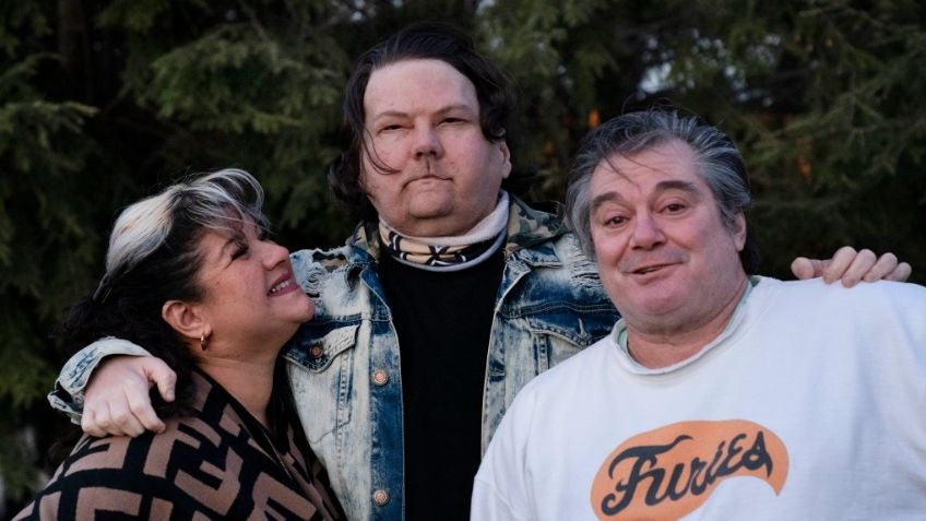 Tras quedar desfigurado en accidente, hombre se somete a trasplante de rostro y se ve irreconocible