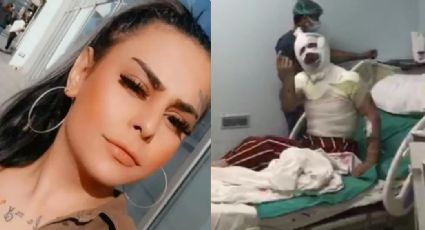 Su ex la quería muerta: Joven trans sufre BRUTAL ataque con ácido; queda ciega y desfigurada