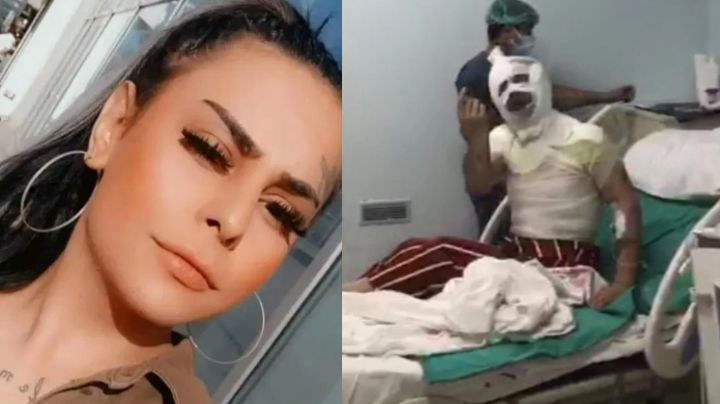 Su ex la quería muerta: Joven trans sufre BRUTAL ataque con ácido; queda ciega y desfigurada
