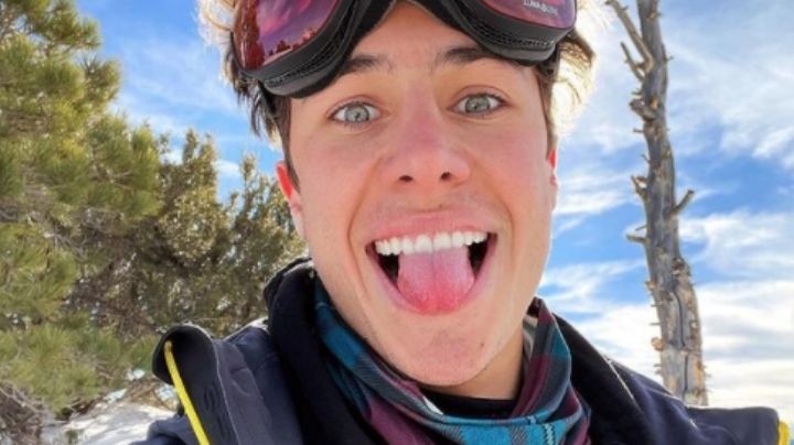 ¡Se quema el rostro! Juanpa Zurita comparte cómo se ve su rostro luego de quemarse con el frío