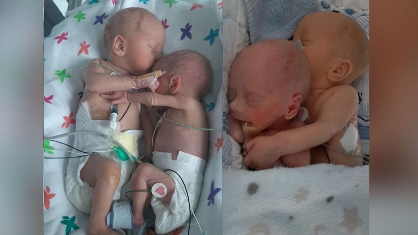 Milagro en hospital: Gemelos prematuros se abrazan; pensaban que un bebé no sobreviviría