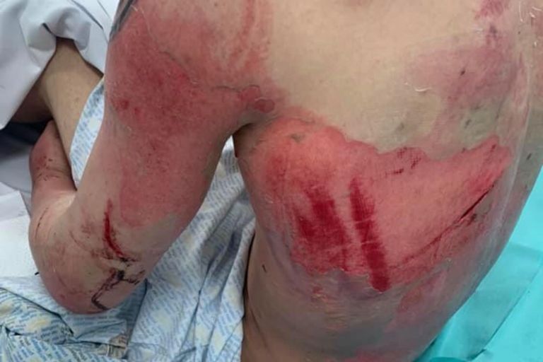 Cobhan Mclelland fue torturado