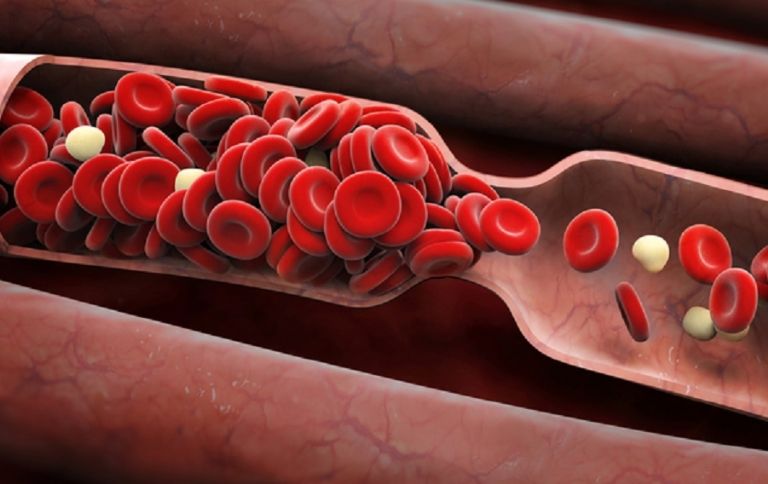 Científicos creen que por esta razón la vacuna de AstraZeneca genera coágulos