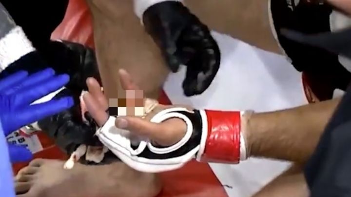 Khetag Pliev: Peleador de MMA pierde un dedo durante una pelea de la UFC