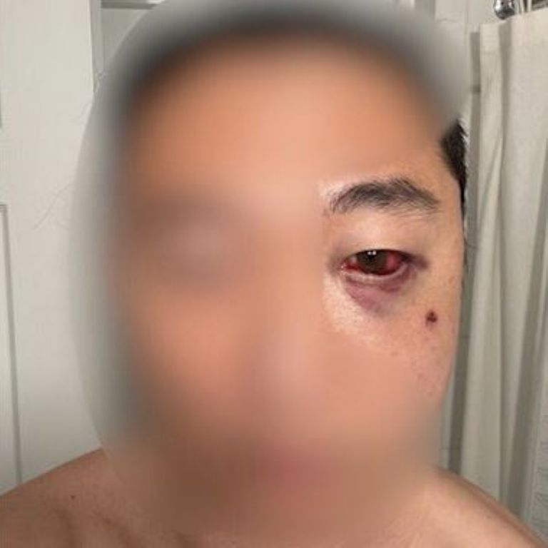 Atacan a hombre asiático en Nueva York en Central Park