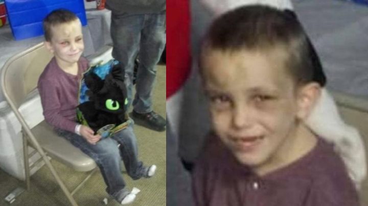 ¡Indignante! Abuelita deja morir a su nieto a manos de su yerno; lo torturaron por meses