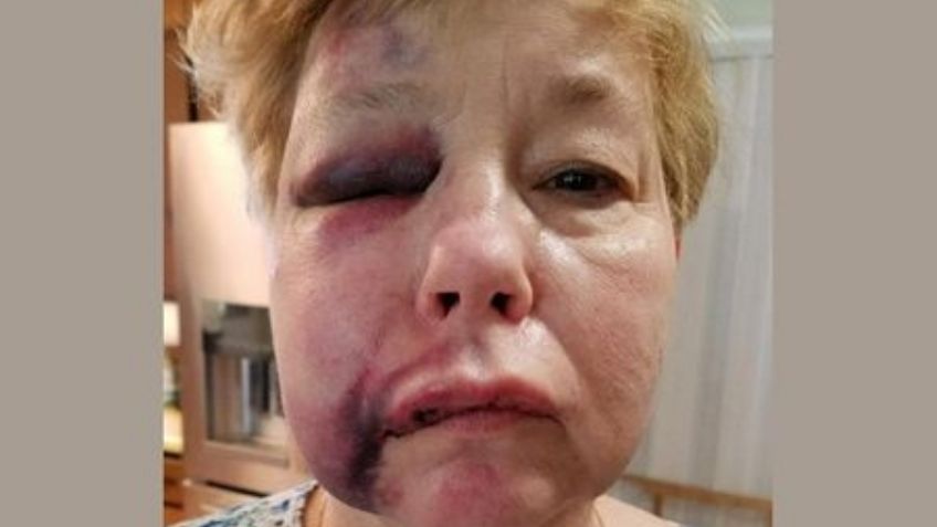 Recluso da una brutal golpiza a una guardia correccional en una prisión de Alabama