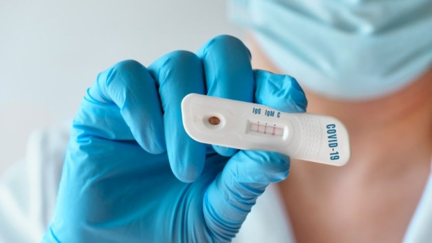 ¡Asombroso! Francia venderá pruebas rápidas para detectar Covid-19 en farmacias