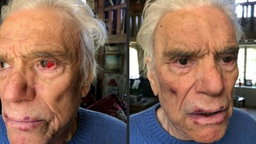 Brutal ataque: Golpean y asaltan a una pareja de ancianos millonarios en su casa