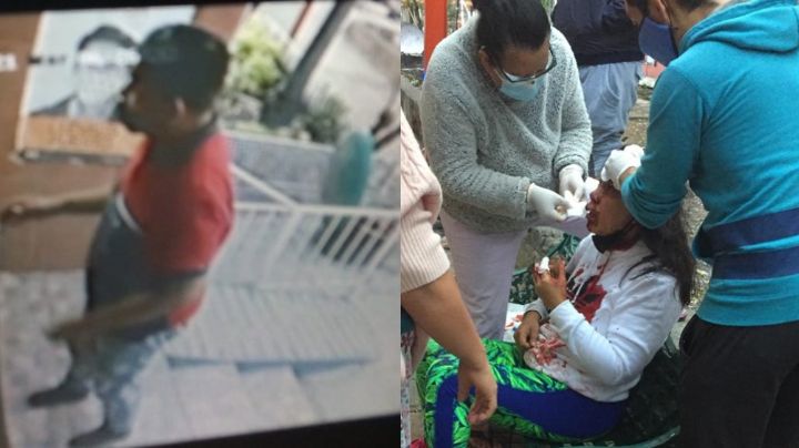 Mujer sangra al ser golpeada con una piedra; un ladrón la atacó para quitarle su celular