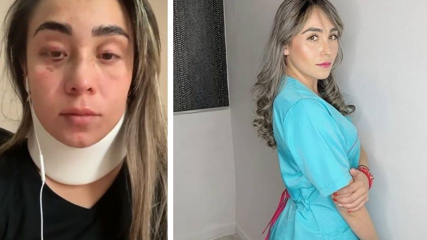 FUERTES IMÁGENES: Kenya Mirelle pide ayuda y denuncia que su ex la intentó matar; está embarazada