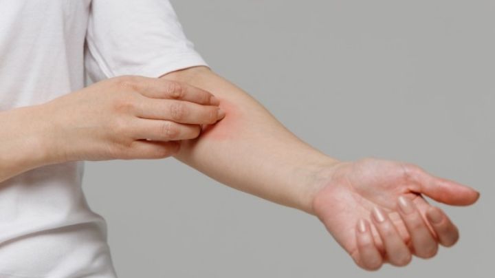 De no creerse: Esta enfermedad del hígado puede llegar a causar comezón