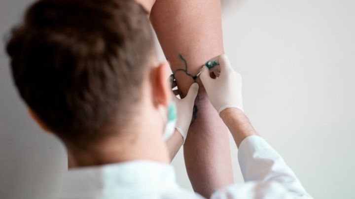 Covid-19: La trombosis ocasionada por las vacunas pueden prevenirse, según expertos