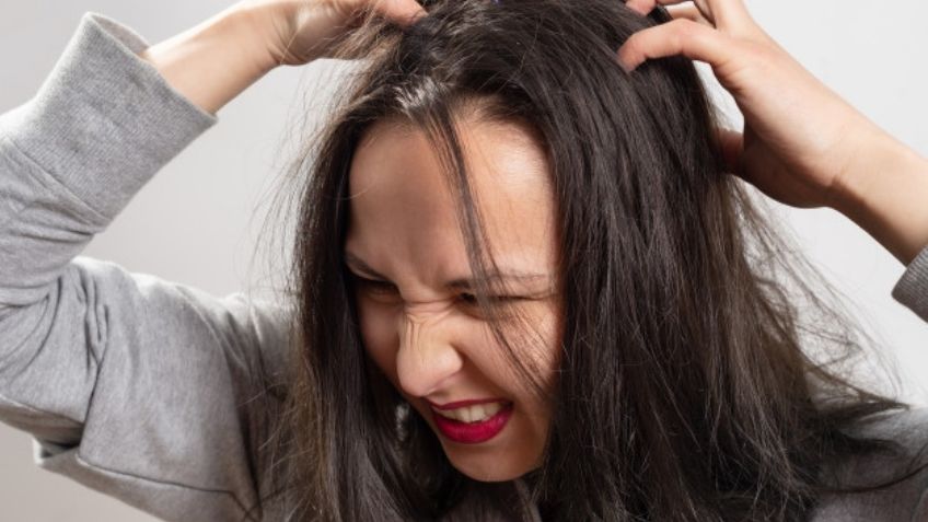 ¿Se pueden evitar los piojos? Esta es la forma en la que los alejarás de tus hijos