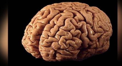 Mal funcionamiento del cerebro podría generar distintas enfermedades neurológicas