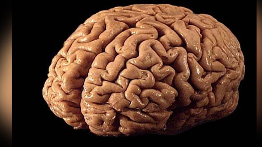 Mal funcionamiento del cerebro podría generar distintas enfermedades neurológicas