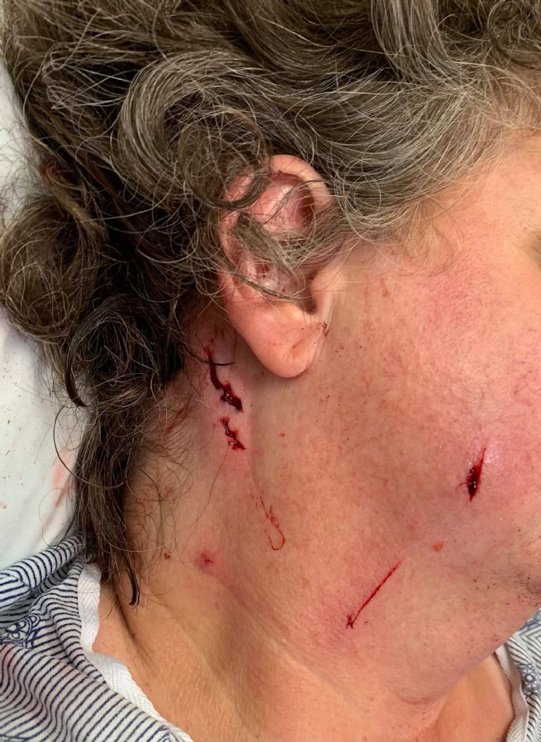 La oficial Melissa Woodall fue atacada con unas tijeras