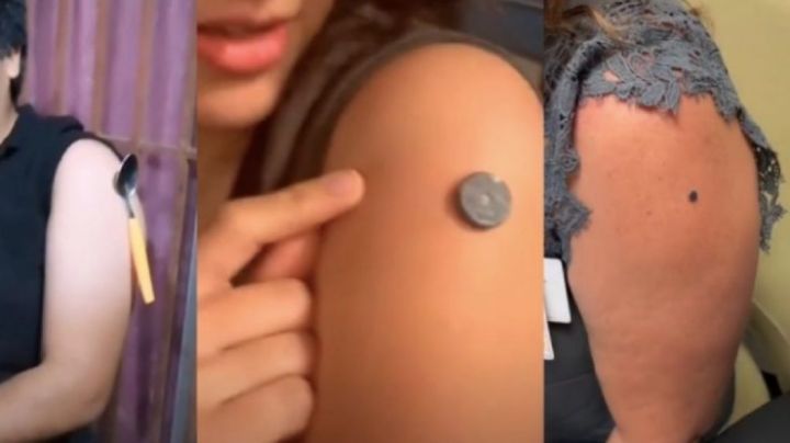 Denuncian "efecto magnético" tras vacunarse contra Covid-19 y los expertos lo desmienten