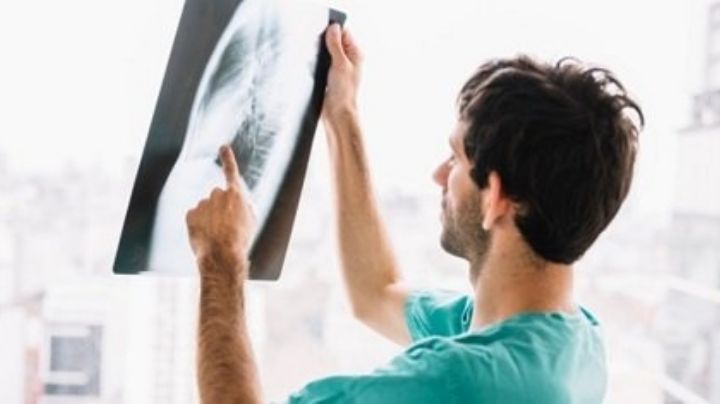 El Covid-19 podría afectar de por vida a los riñones; según un reciente estudio