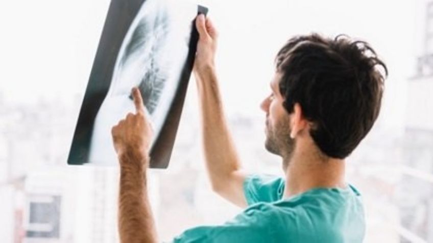 El Covid-19 podría afectar de por vida a los riñones; según un reciente estudio