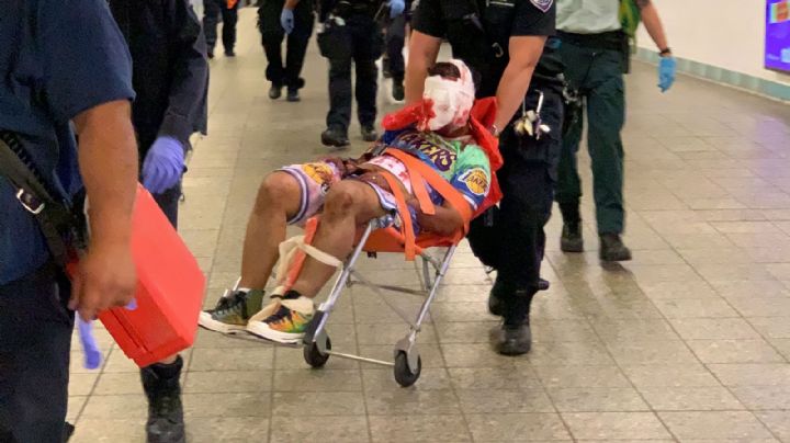 Brutal ataque: Acuchillan en la cabeza a un hombre que esperaba en una estación del metro