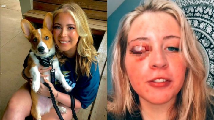 Va a ponerse pestañas y termina sin párpado: Perro Chihuahua ataca a una joven en la cara