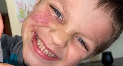 Niño de 5 años termina desfigurado tras ser brutalmente atacado por el perro de su niñera