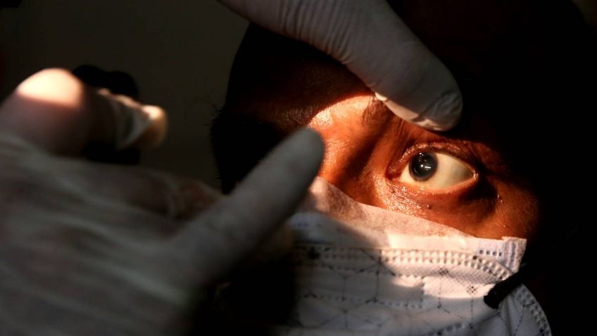 ¡Atención! IMSS niega que se presentara primer caso de 'hongo negro' en México