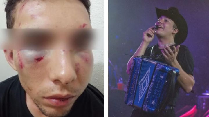 Remmy Valenzuela: Lo denuncian en la FGE por azotar a mujer con cable y brutal golpiza a su primo