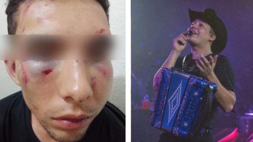 Remmy Valenzuela: Lo denuncian en la FGE por azotar a mujer con cable y brutal golpiza a su primo