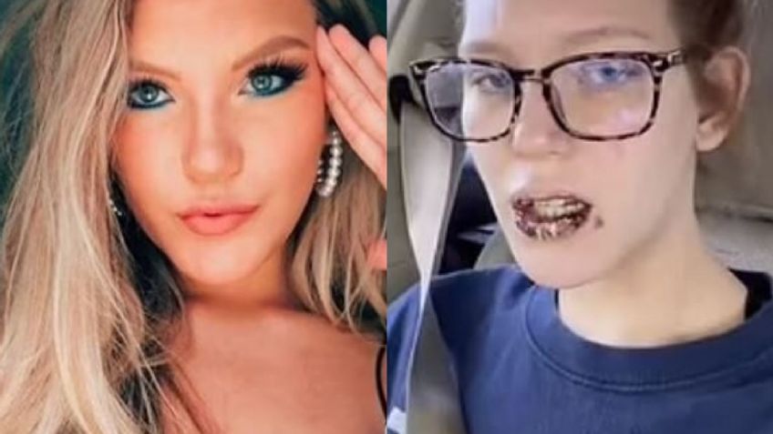 FOTOS: Tras tener la variante Delta, los labios de esta mujer se hicieron negros y con dolorosas costras