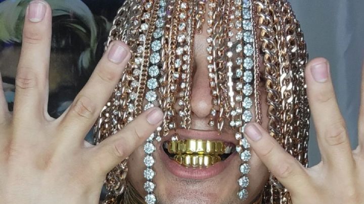 FOTOS: El rapero Dan Sur pasa a la historia al implantarse cadenas de oro en el cuero cabelludo