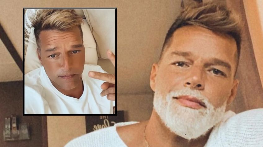 ¿Exceso de bótox? Ricky Martin se viraliza por 'desmedido arreglito' en el rostro; redes lo tunden