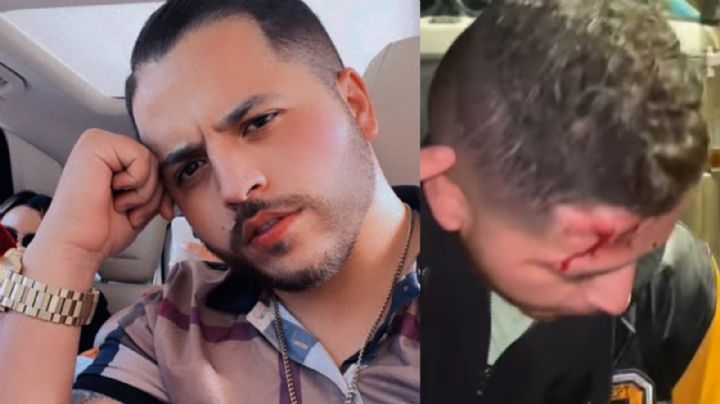 Terror en el regional mexicana: Famoso cantante sufre asalto a mano armada y le dan brutal golpiza