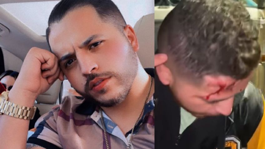 Terror en el regional mexicana: Famoso cantante sufre asalto a mano armada y le dan brutal golpiza