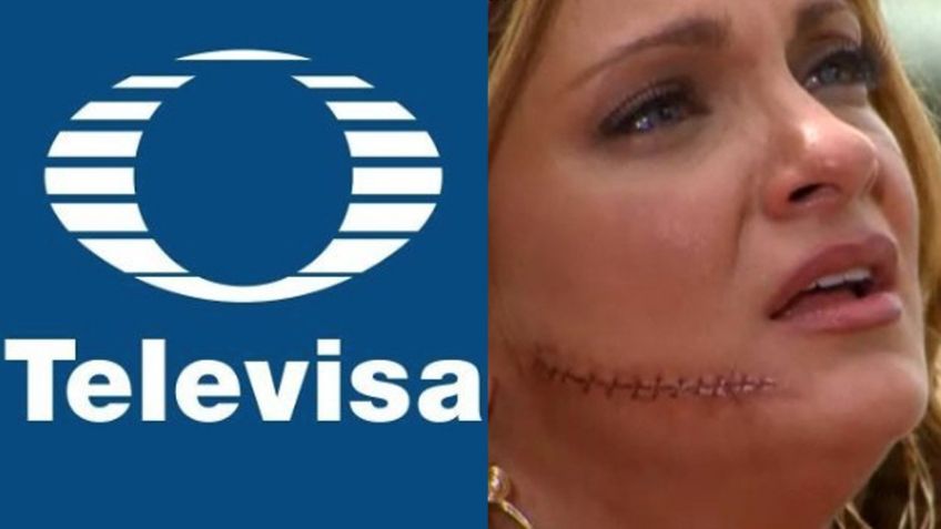 Adiós TV Azteca: Tras acabar desfigurada y llegar a 'VLA', actriz supera veto y vuelve a Televisa