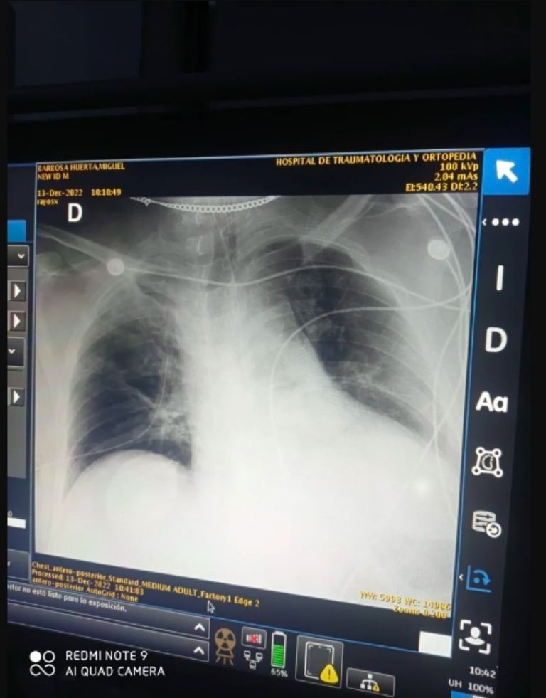 Presunta radiografía de Miguel Barbosa 