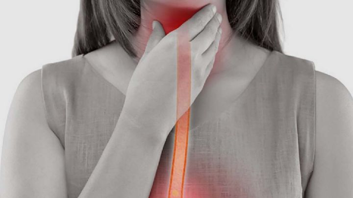 Alerta: Expertos revelan cuáles podrían ser los síntomas del cáncer de esófago