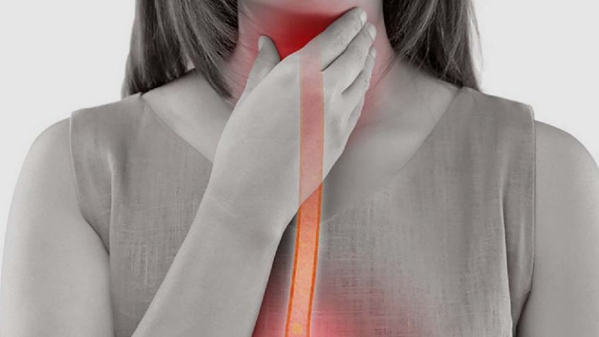 Alerta: Expertos revelan cuáles podrían ser los síntomas del cáncer de esófago