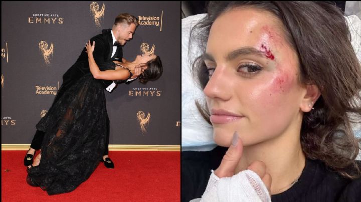 De terror: Estrellas de TV sufren aterrador accidente; ambos aparecen heridos en Instagram