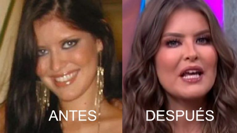 Antes y después de Vanessa Claudio