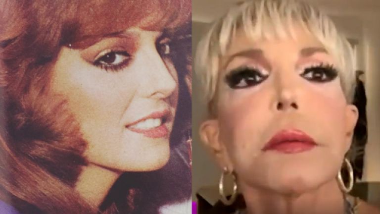 sufrió una fuerte infección en el rostro debido a una bacteria, la cual deformó sus facciones. Además, se sometió a diversas cirugías, mismas que la dejaron desfigurada.