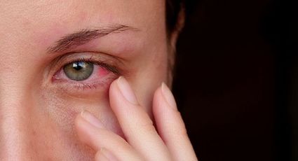 ¿Tienen relación? Estudio señala presencia de derrame en ojos como secuela de Covid-19