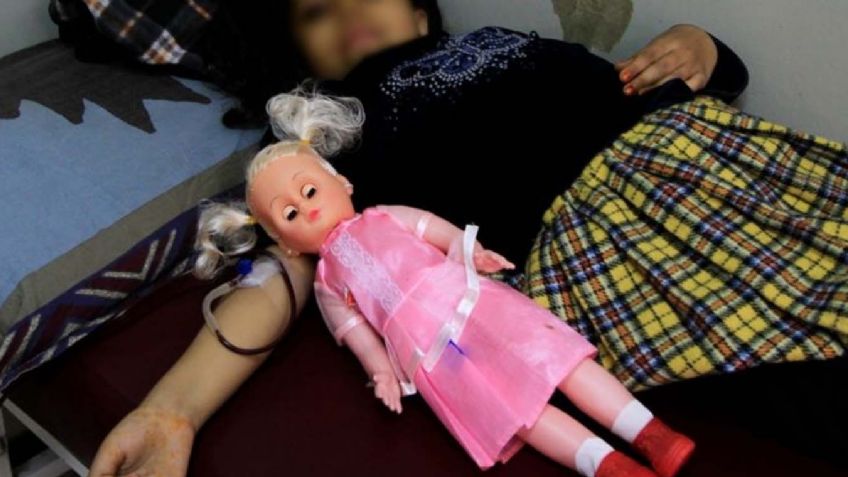 'Mañanera' de AMLO: Esto es todo lo que se sabe sobre la hepatitis aguda infantil en México