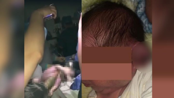 Tras quedarse sin luz en hospital, realizan cesárea con celulares; le cortaron la oreja al bebé