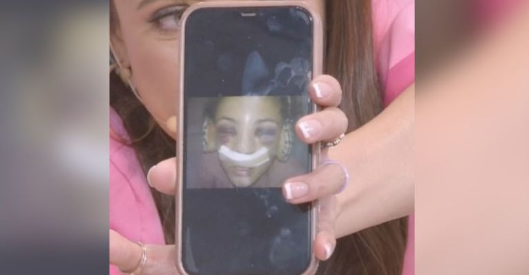 Jessica Segura tras sufrir accidente