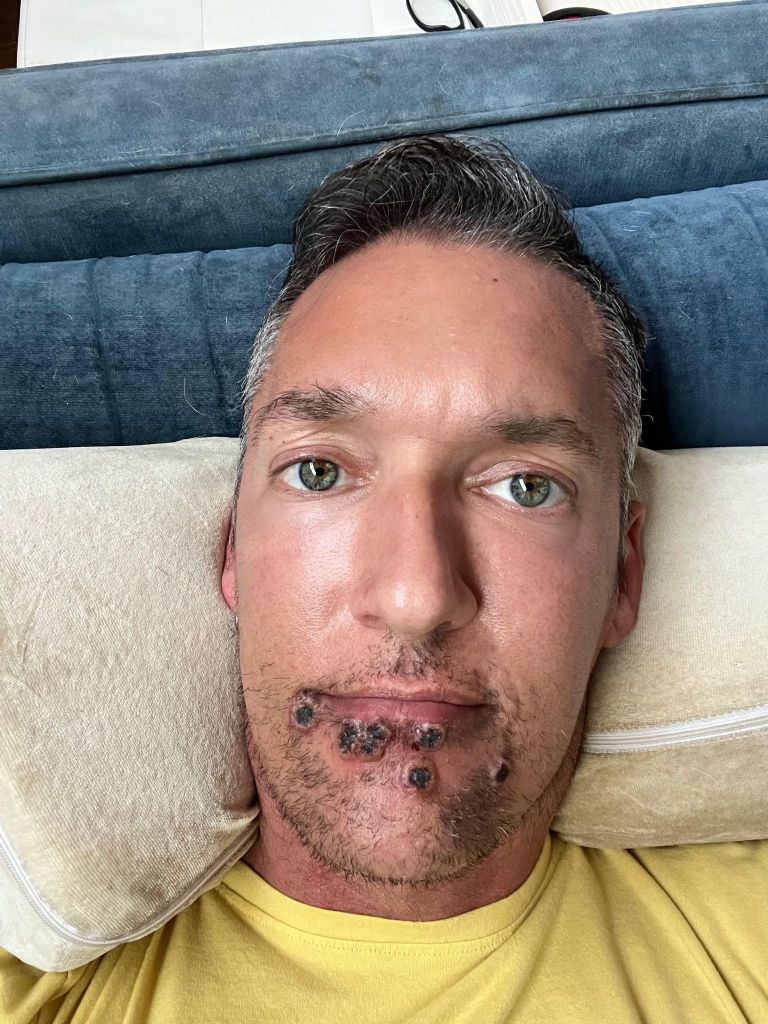 El actor Silver Steele compartió su experiencia tras contraer la viruela del mono. Foto: Twitter