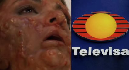 Se desfiguró: Tras perder exclusividad en Televisa, ejecutivos corren y vetan a villana de novelas